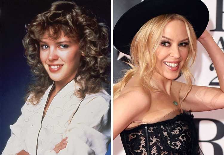 19 Kylie Minogue prima e dopo ieri e oggi 19 Kylie Minogue prima e dopo ieri e oggi