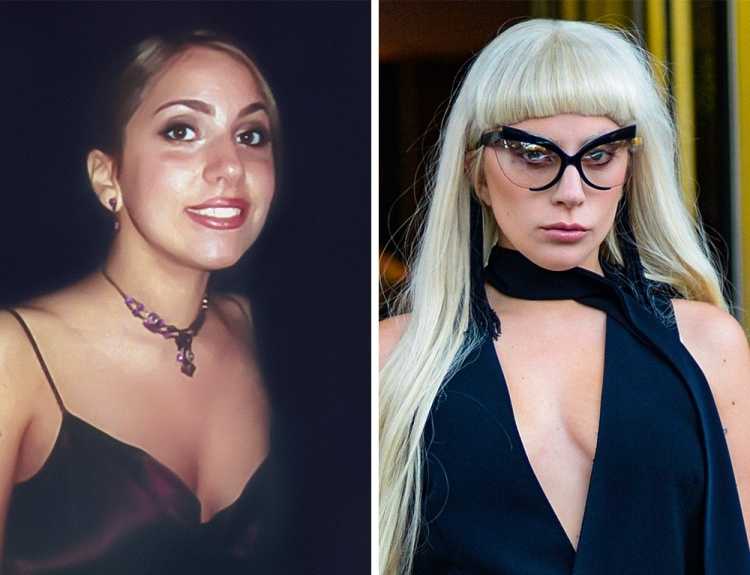 3 Lady Gaga prima e dopo ieri e oggi 3 Lady Gaga prima e dopo ieri e oggi